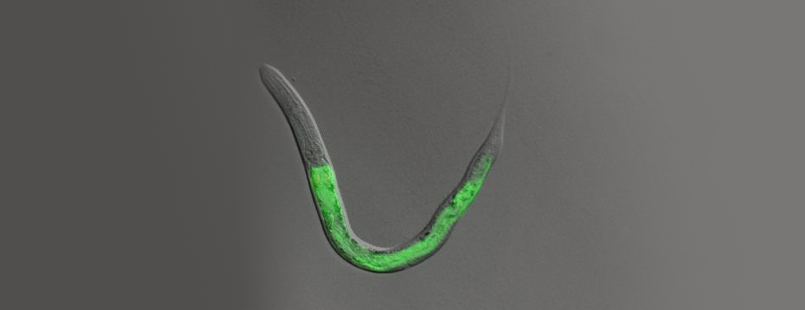 Toxicogenomics Nematodes